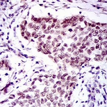 FOXP1 Mouse Monoclonal Antibody