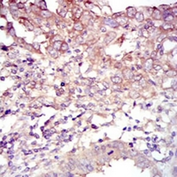FOXO1 Mouse Monoclonal Antibody