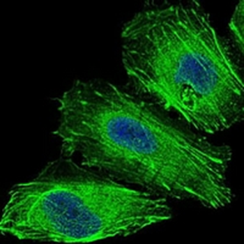 FOXO1 Mouse Monoclonal Antibody