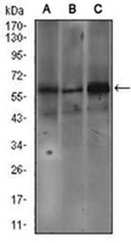 Fc epsilon RI alpha Mouse Monoclonal Antibody