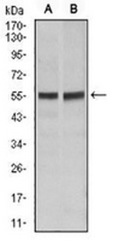 CD95 Mouse Monoclonal Antibody