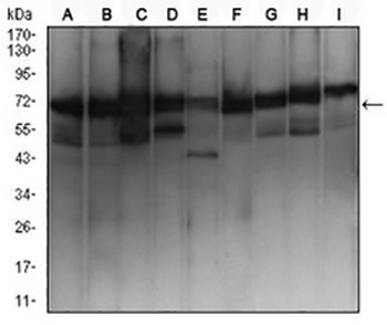 Ezrin Mouse Monoclonal Antibody