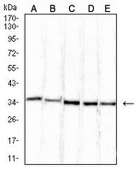 ETFA Mouse Monoclonal Antibody