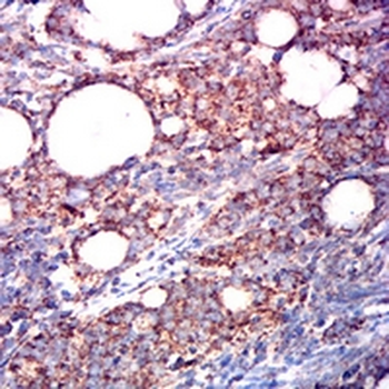 ETFA Mouse Monoclonal Antibody