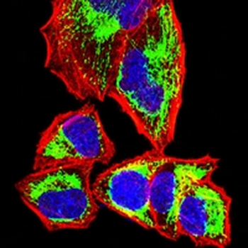 ETFA Mouse Monoclonal Antibody