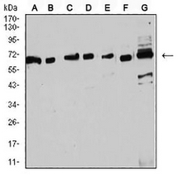 Estrogen Receptor alpha Mouse Monoclonal Antibody