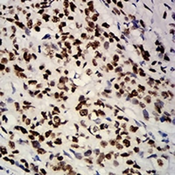 Estrogen Receptor alpha Mouse Monoclonal Antibody
