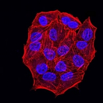 Estrogen Receptor alpha Mouse Monoclonal Antibody