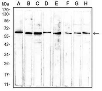 ERCC1 Mouse Monoclonal Antibody
