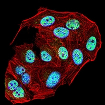 ERCC1 Mouse Monoclonal Antibody