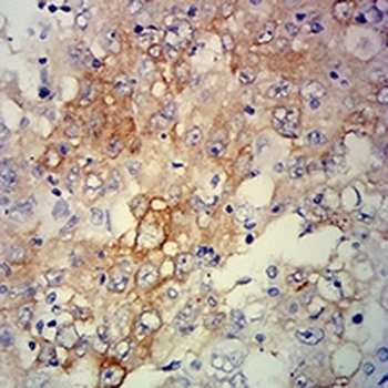ERCC1 Mouse Monoclonal Antibody