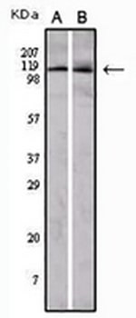 EPHA1 Mouse Monoclonal Antibody