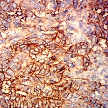 CD326 Mouse Monoclonal Antibody