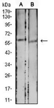 CD39 Mouse Monoclonal Antibody
