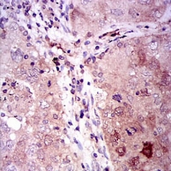 Gamma-enolase Mouse Monoclonal Antibody
