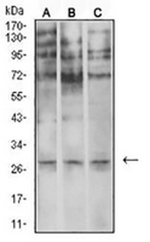 Neutrophil Elastase Mouse Monoclonal Antibody