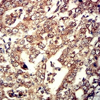 Neutrophil Elastase Mouse Monoclonal Antibody