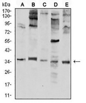 Neutrophil Elastase Mouse Monoclonal Antibody