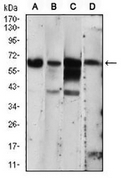 PKR Mouse Monoclonal Antibody