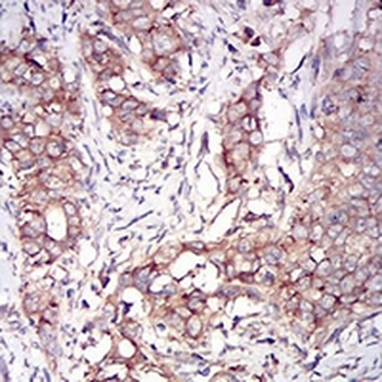 PKR Mouse Monoclonal Antibody