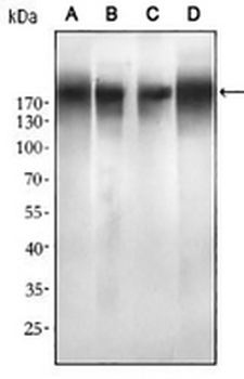 EGFR Mouse Monoclonal Antibody