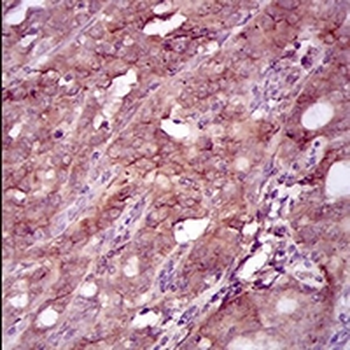 EGFR Mouse Monoclonal Antibody