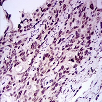E2F1 Mouse Monoclonal Antibody