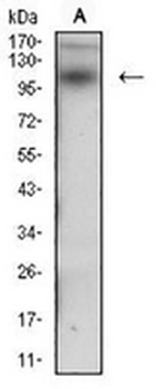 Desmoglein 3 Mouse Monoclonal Antibody