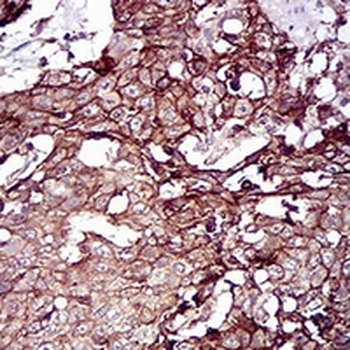 Desmoglein 3 Mouse Monoclonal Antibody