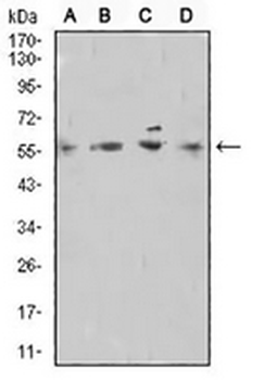 TdT Mouse Monoclonal Antibody