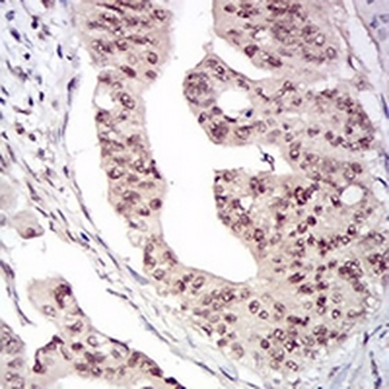 DNMT1 Mouse Monoclonal Antibody