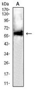 DLL3 Mouse Monoclonal Antibody
