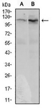 DIS3L2 Mouse Monoclonal Antibody