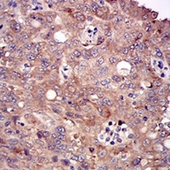 DIS3L2 Mouse Monoclonal Antibody