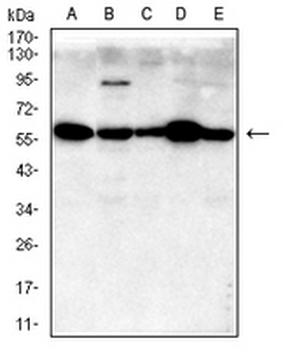 Desmin Mouse Monoclonal Antibody
