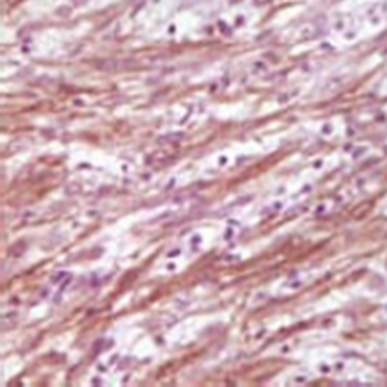 Desmin Mouse Monoclonal Antibody
