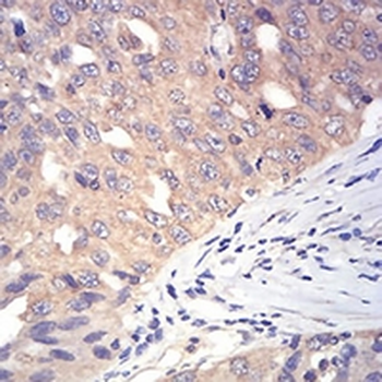 DDX3X Mouse Monoclonal Antibody