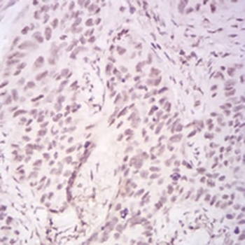 DDX39B Mouse Monoclonal Antibody