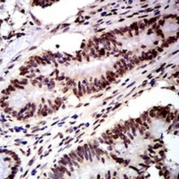 DDX1 Mouse Monoclonal Antibody