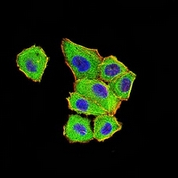 DDX1 Mouse Monoclonal Antibody