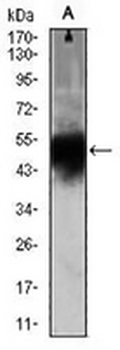 Doublecortin Mouse Monoclonal Antibody
