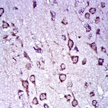Doublecortin Mouse Monoclonal Antibody