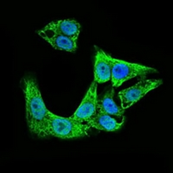 Doublecortin Mouse Monoclonal Antibody