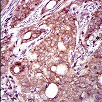 DCTN4 Mouse Monoclonal Antibody