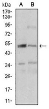 DAP Kinase 3 Mouse Monoclonal Antibody