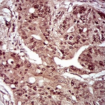 DAP Kinase 3 Mouse Monoclonal Antibody