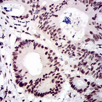 CTNNBL1 Mouse Monoclonal Antibody