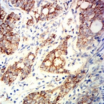 Beta-catenin Mouse Monoclonal Antibody