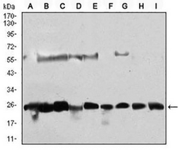 CK2 beta Mouse Monoclonal Antibody