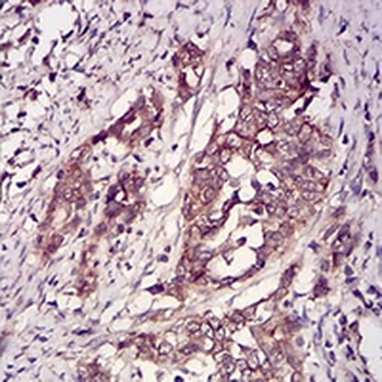CK2 beta Mouse Monoclonal Antibody